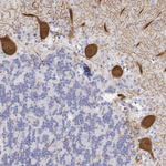 Calbindin D28K Antibody in Immunohistochemistry (Paraffin) (IHC (P))