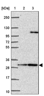 Calbindin D28K Antibody in Western Blot (WB)