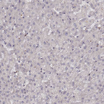 Zyxin Antibody in Immunohistochemistry (Paraffin) (IHC (P))