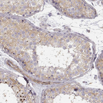 Zyxin Antibody in Immunohistochemistry (Paraffin) (IHC (P))