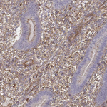 Zyxin Antibody in Immunohistochemistry (Paraffin) (IHC (P))