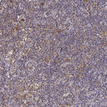 Zyxin Antibody in Immunohistochemistry (Paraffin) (IHC (P))