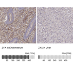 Zyxin Antibody in Immunohistochemistry (Paraffin) (IHC (P))