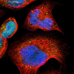 Cytochrome P450 Reductase Polyclonal Antibody