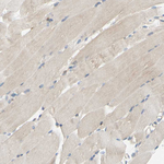 Cytochrome P450 Reductase Antibody in Immunohistochemistry (Paraffin) (IHC (P))