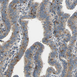 Cytochrome P450 Reductase Antibody in Immunohistochemistry (Paraffin) (IHC (P))