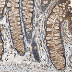 Cytochrome P450 Reductase Antibody in Immunohistochemistry (Paraffin) (IHC (P))