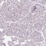Mitofilin Antibody in Immunohistochemistry (Paraffin) (IHC (P))