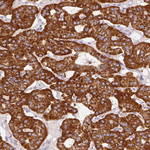 Mitofilin Antibody in Immunohistochemistry (Paraffin) (IHC (P))