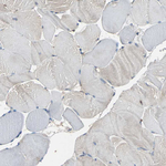 NDRG1 Antibody in Immunohistochemistry (Paraffin) (IHC (P))