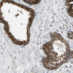 NDRG1 Antibody in Immunohistochemistry (Paraffin) (IHC (P))