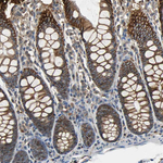 NDRG1 Antibody in Immunohistochemistry (Paraffin) (IHC (P))