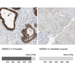 NDRG1 Antibody in Immunohistochemistry (Paraffin) (IHC (P))