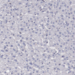 Synaptophysin Antibody in Immunohistochemistry (Paraffin) (IHC (P))