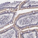 Synaptophysin Antibody in Immunohistochemistry (Paraffin) (IHC (P))