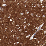 Synaptophysin Antibody in Immunohistochemistry (Paraffin) (IHC (P))