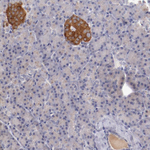 Synaptophysin Antibody in Immunohistochemistry (Paraffin) (IHC (P))