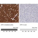 Synaptophysin Antibody in Immunohistochemistry (Paraffin) (IHC (P))