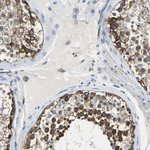 ZO-2 Antibody in Immunohistochemistry (Paraffin) (IHC (P))