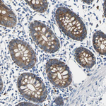 ZO-2 Antibody in Immunohistochemistry (Paraffin) (IHC (P))