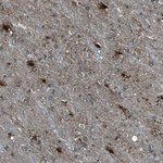ZO-2 Antibody in Immunohistochemistry (Paraffin) (IHC (P))