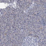 CD147 Antibody in Immunohistochemistry (Paraffin) (IHC (P))
