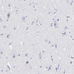 FABP4 Antibody in Immunohistochemistry (Paraffin) (IHC (P))