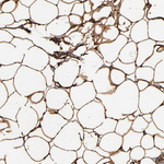 FABP4 Antibody in Immunohistochemistry (Paraffin) (IHC (P))