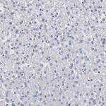 FABP4 Antibody in Immunohistochemistry (Paraffin) (IHC (P))