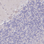 ADFP Antibody in Immunohistochemistry (Paraffin) (IHC (P))