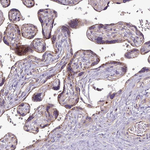 ADFP Antibody in Immunohistochemistry (Paraffin) (IHC (P))