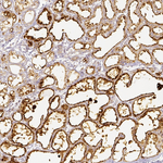 ADFP Antibody in Immunohistochemistry (Paraffin) (IHC (P))