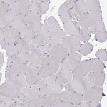 Claudin 1 Antibody in Immunohistochemistry (Paraffin) (IHC (P))