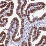 Claudin 1 Antibody in Immunohistochemistry (Paraffin) (IHC (P))
