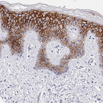 Claudin 1 Antibody in Immunohistochemistry (Paraffin) (IHC (P))