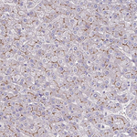 Claudin 1 Antibody in Immunohistochemistry (Paraffin) (IHC (P))
