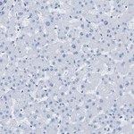 Desmin Antibody in Immunohistochemistry (Paraffin) (IHC (P))