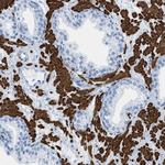 Desmin Antibody in Immunohistochemistry (Paraffin) (IHC (P))