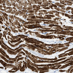 Desmin Antibody in Immunohistochemistry (Paraffin) (IHC (P))