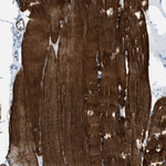 Desmin Antibody in Immunohistochemistry (Paraffin) (IHC (P))
