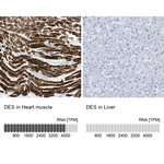 Desmin Antibody in Immunohistochemistry (Paraffin) (IHC (P))