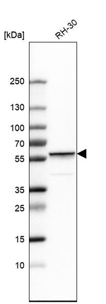 Desmin Antibody in Western Blot (WB)