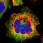 FASN Polyclonal Antibody