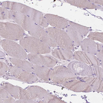 FASN Antibody in Immunohistochemistry (Paraffin) (IHC (P))