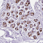 FASN Antibody in Immunohistochemistry (Paraffin) (IHC (P))