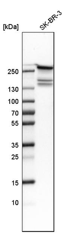 FASN Antibody in Western Blot (WB)