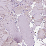 FASN Antibody in Immunohistochemistry (Paraffin) (IHC (P))