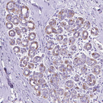 FASN Antibody in Immunohistochemistry (Paraffin) (IHC (P))