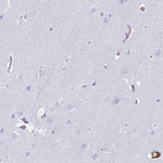 Annexin A2 Antibody in Immunohistochemistry (Paraffin) (IHC (P))