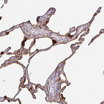 Annexin A2 Antibody in Immunohistochemistry (Paraffin) (IHC (P))